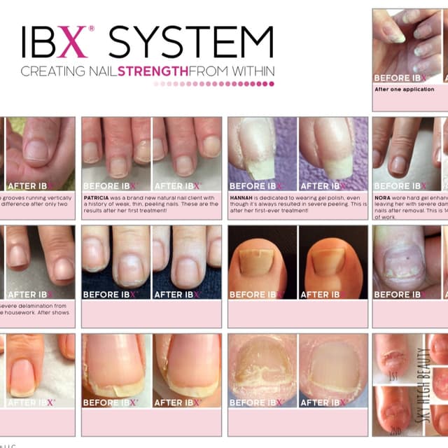 IBX TREATMENT + Maintenance at FFNAILSTUDIO in Chicago, IL